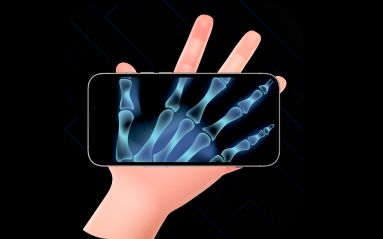 Aplicativos Incríveis para Visualizar Raio-X no celular